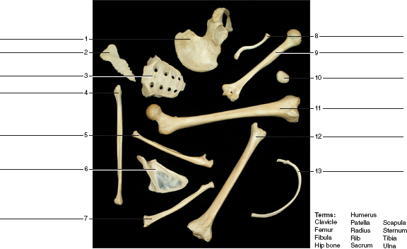 Solved: Identify the bones indicated in figure 13.4.Figure 13.4 Id