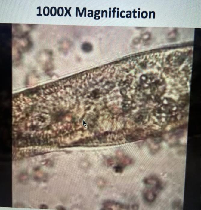 1000X Magnification