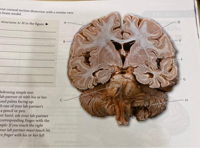 Solved our coronal section dissection with a similar view | Chegg.com