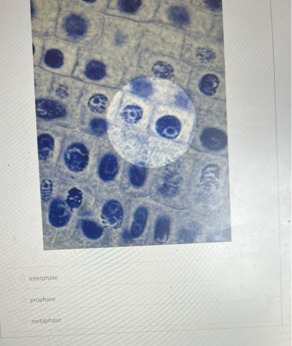 Solved What phase is highlighted in the image? interphase | Chegg.com