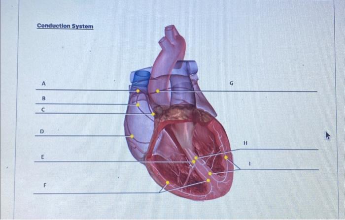 Solved [Choose ] middle internodal bundle interatrial | Chegg.com