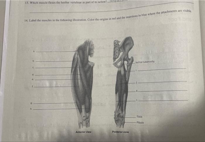 Solved 14. Label the mucles in the following illustration. | Chegg.com