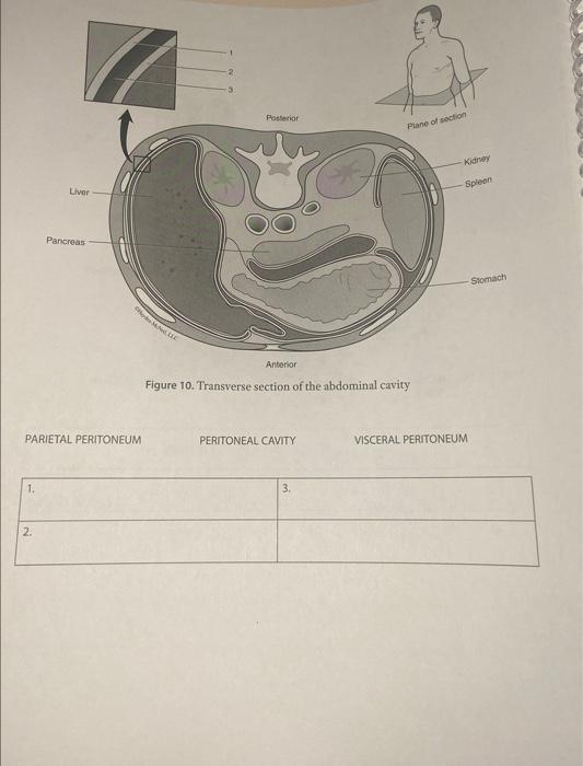 Solved Figure 10. Transverse section of the abdominal cavity | Chegg.com