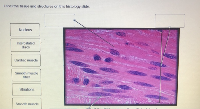 Solved Label The Tissue And Structures On This Histology