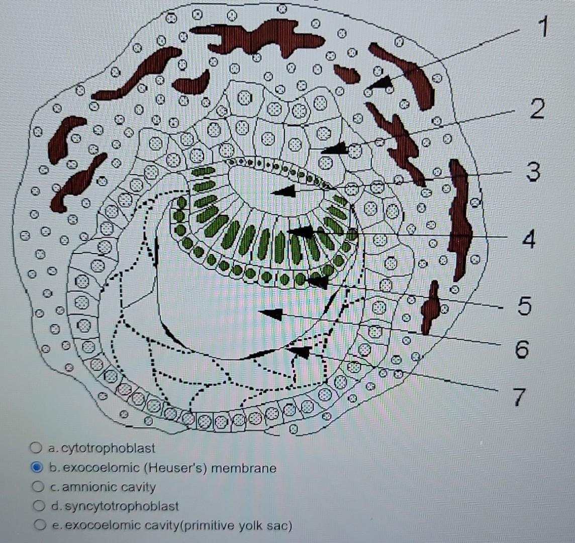 b. exocoelomic (Heusers) membrane
c. amnionic cavity
d. syncytotrophoblast
e. exocoelomic cavity(primitive yolk sac)