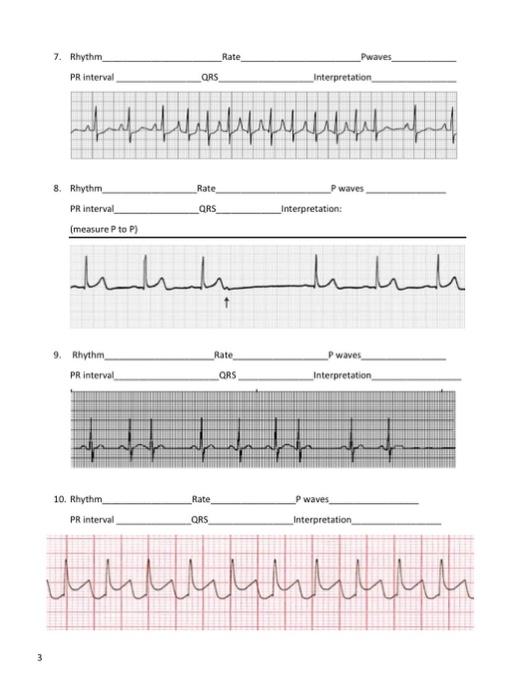 Solved 7. Rhythm Rate Pwaves PR interval QRS Interpretation | Chegg.com