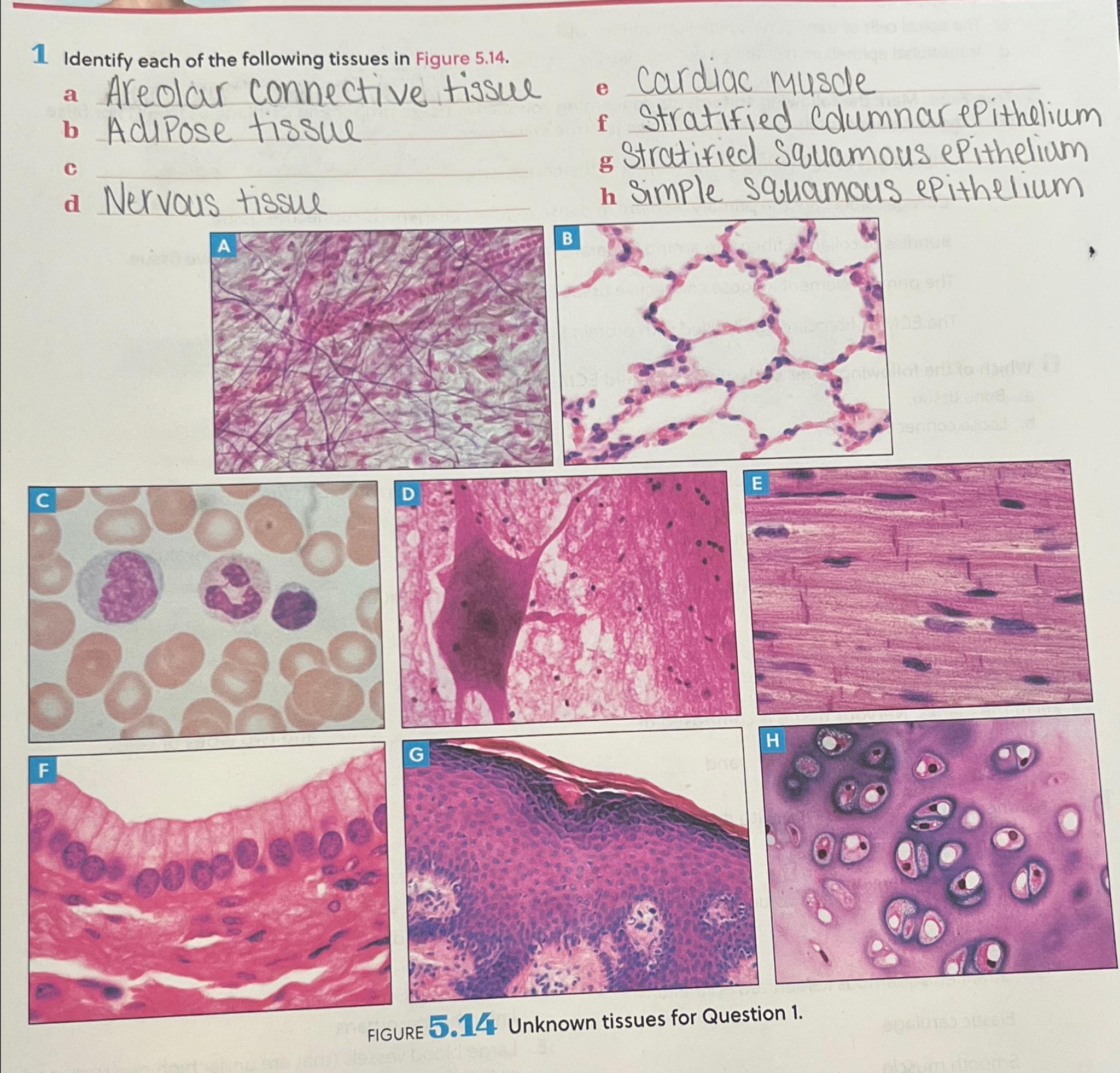 Solved 1 ﻿Identify each of the following tissues in Figure | Chegg.com