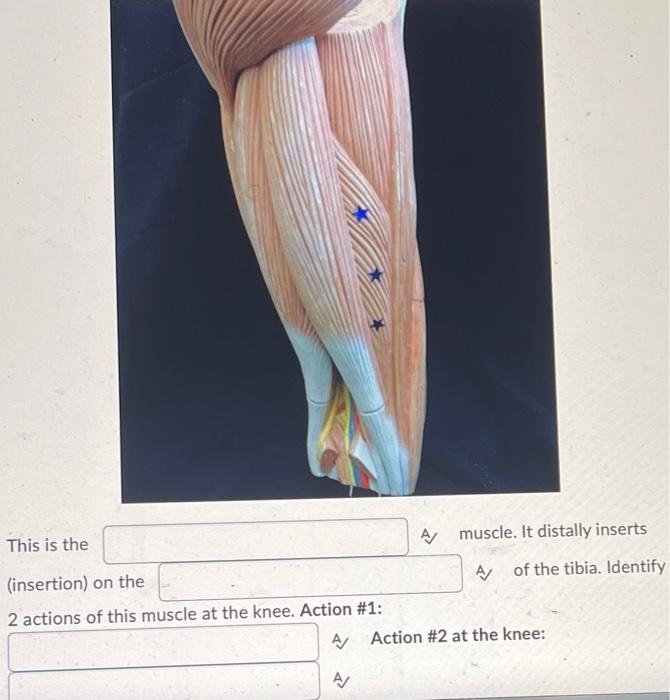 Solved 1. Identify the bony landmark of the knee, and the 2 | Chegg.com