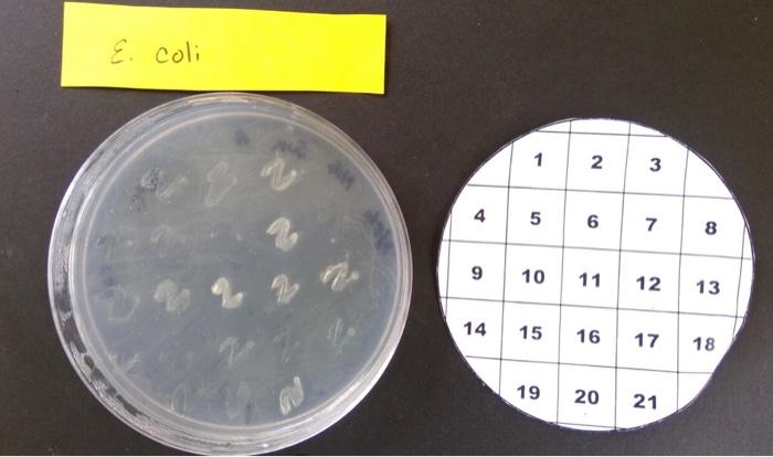 Solved 1) What is your your favorite bacterial PATCH#? Why | Chegg.com