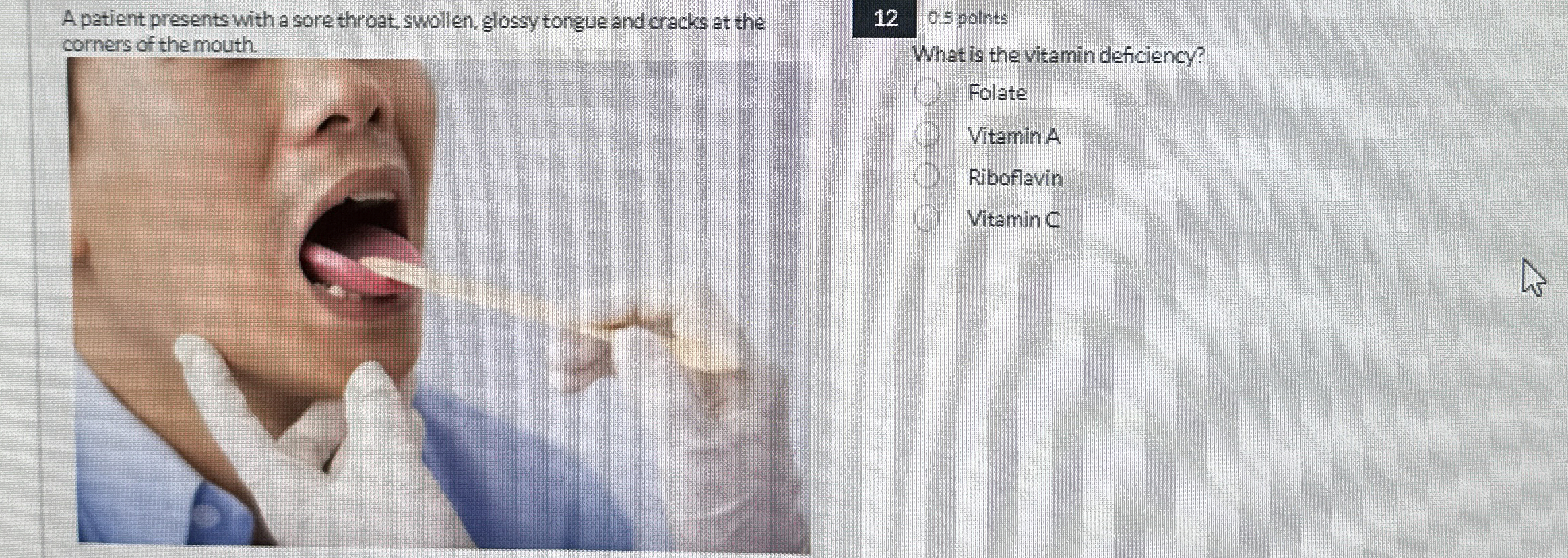 Solved A patient presents with a sore throat swollen, glossy