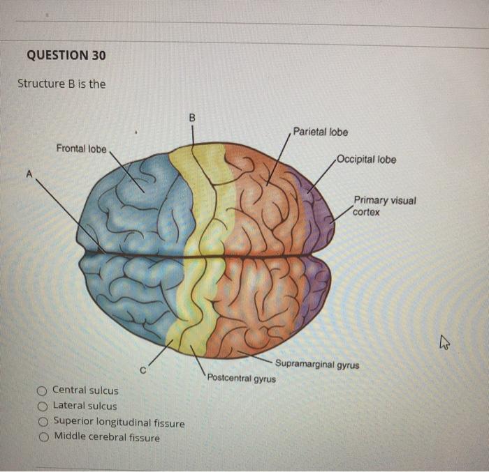 Solved QUESTION 30 Structure B is the B Parietal lobe | Chegg.com