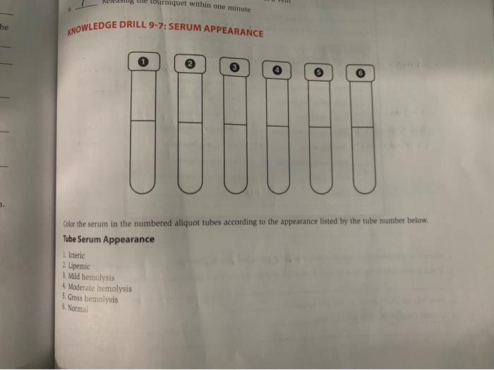 Solved Colar the serum in the numbered aliquot tubes | Chegg.com