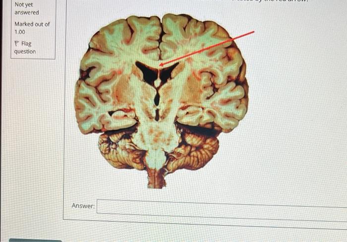 Solved C D E F A А. B Consider the image above. Identify the | Chegg.com