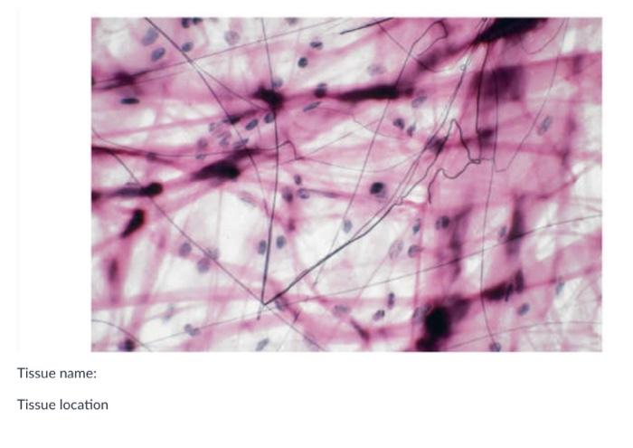 Solved Tissue Name: Tissue Location (only 1): Tissue | Chegg.com