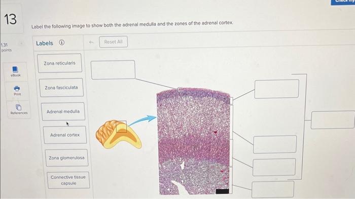 Label the following image to show both the adrenal medulla and the zones of the adrenai cortex.