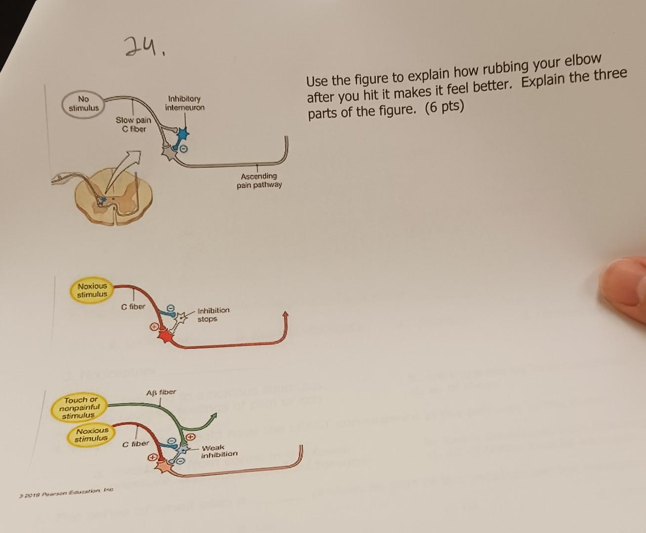 Use the figure to explain how rubbing your elbow