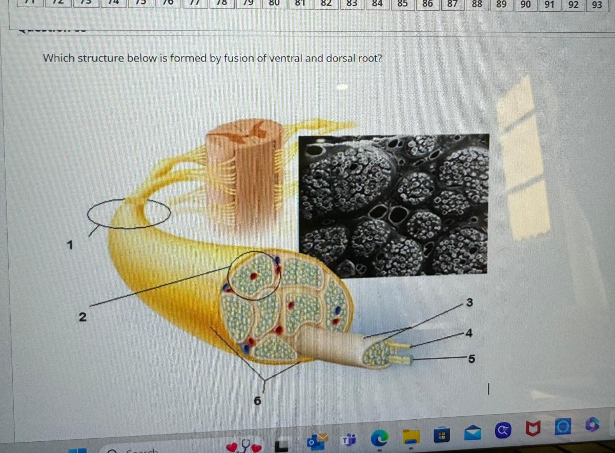 Solved Which structure below is formed by fusion of ventral | Chegg.com