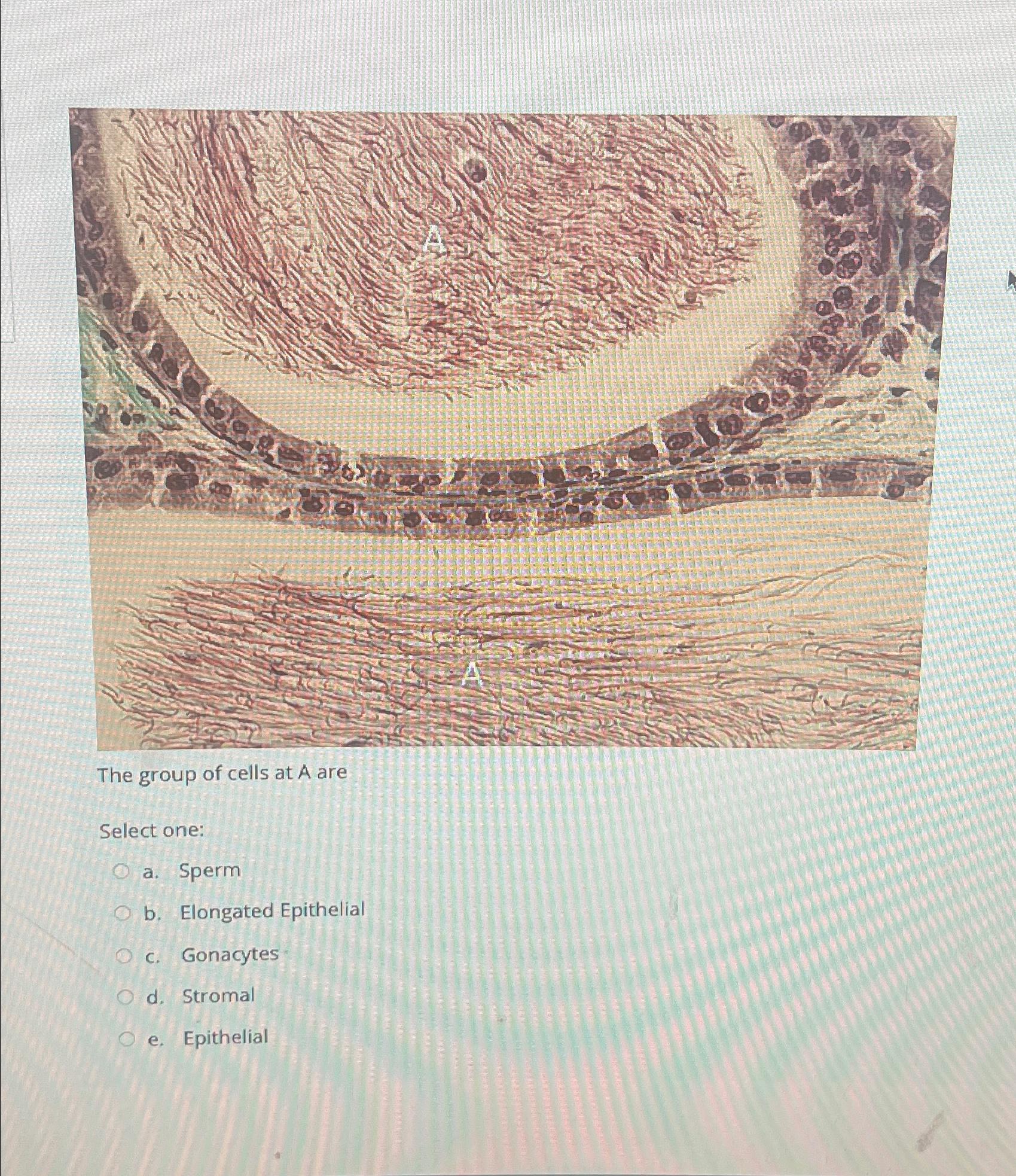 Solved The group of cells at A areSelect one:a. ﻿Spermb. | Chegg.com