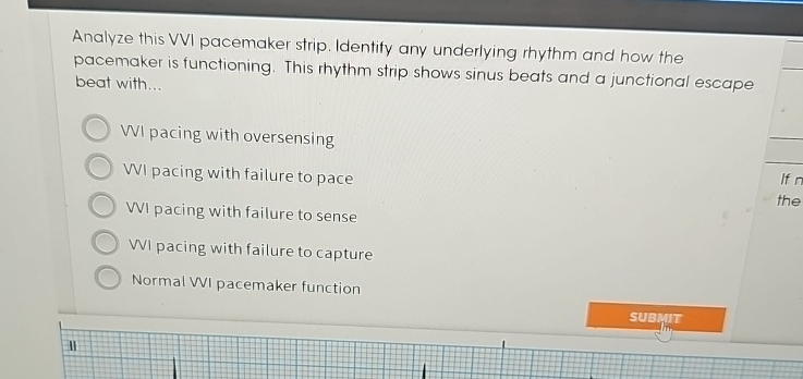 Solved Analyze this VVI pacemaker strip. Identify any | Chegg.com