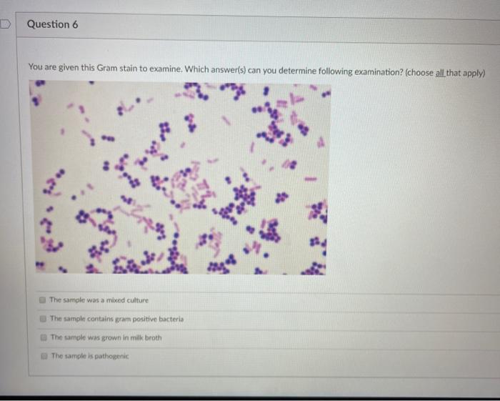Solved Question 6 You are given this Gram stain to examine. | Chegg.com