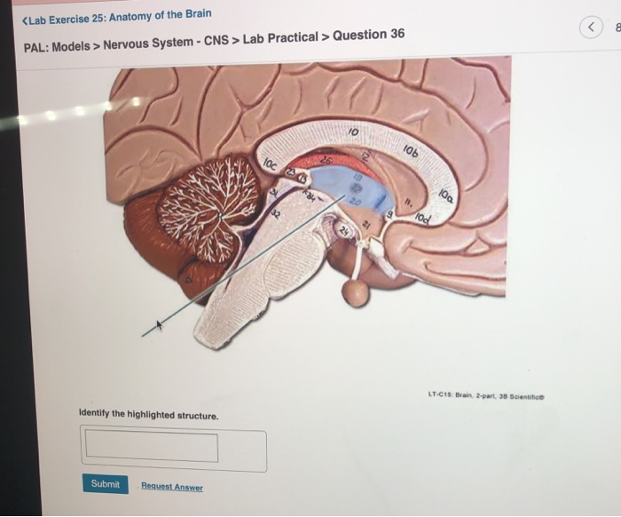 Solved Nervous System Cns Lab Practical Question 36