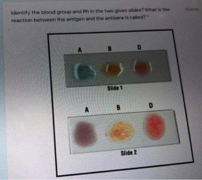 Solved Calculate the bleeding time from the data shown on