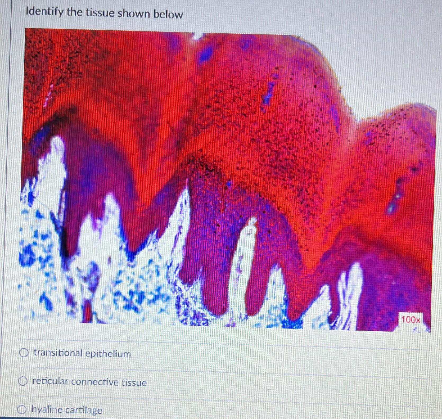Solved Identify the tissue shown below ﻿transitional | Chegg.com