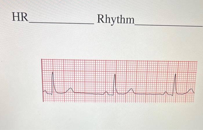 Solved HR RhythmHR Rhythm | Chegg.com
