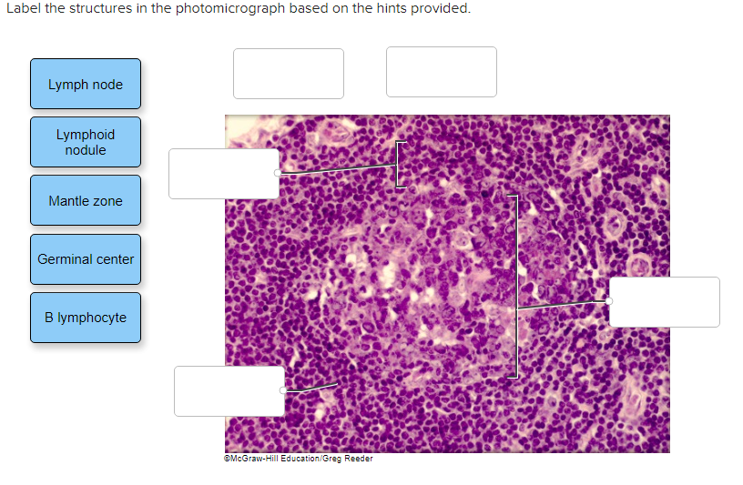 Solved Label the structures in the photomicrograph based on | Chegg.com