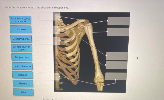 Solved Label the bony structures of the shoulder and upper | Chegg.com