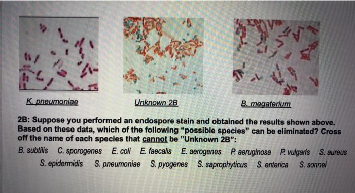 staphylococcus epidermidis endospore stain