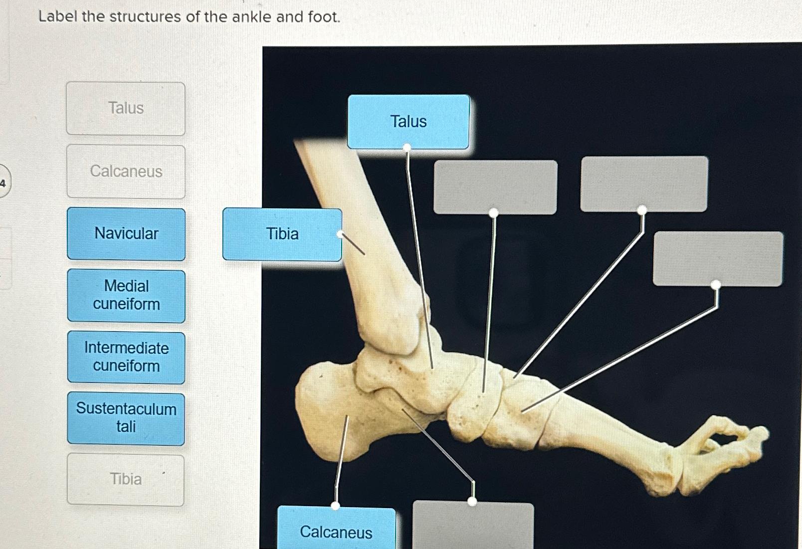 Solved Label the structures of the ankle and foot. | Chegg.com