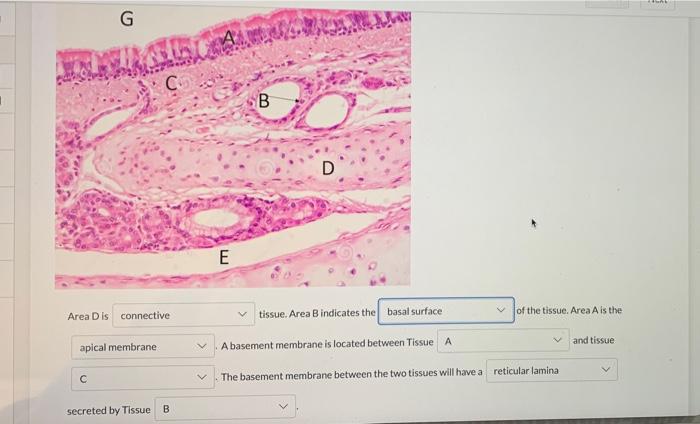 Solved G C 1 B D E Area Disconnective tissue. Area B | Chegg.com