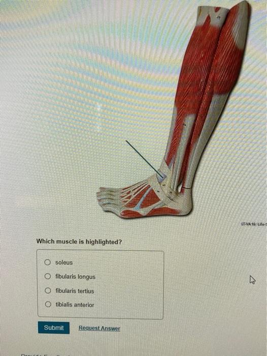 Solved LTVA 15Life Which muscle is highlighted? O soleus O