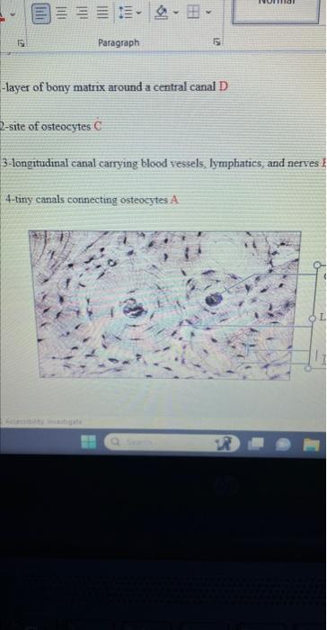 -layer of bony matrix around a central canal D 2-site | Chegg.com