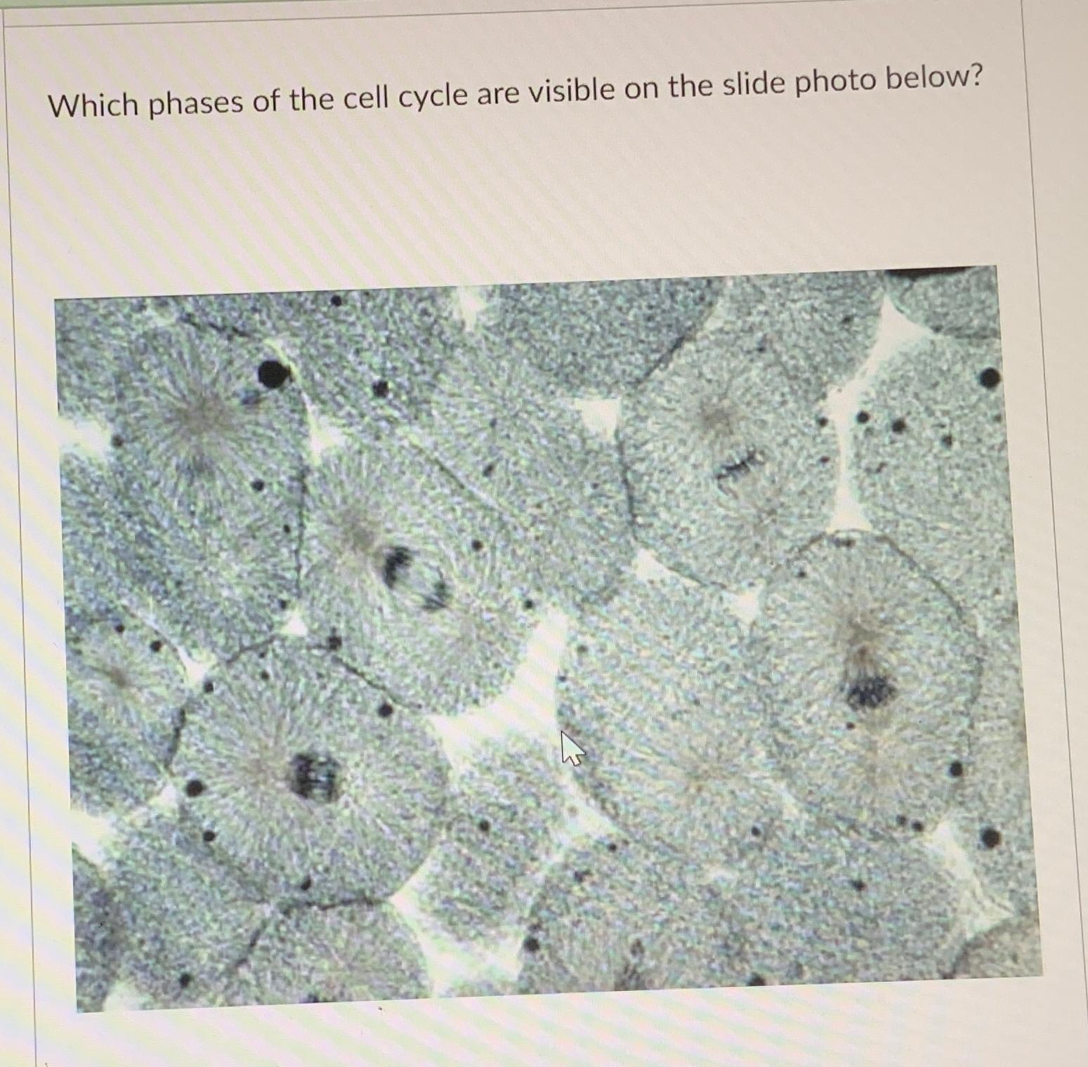 Solved Which phases of the cell cycle are visible on the | Chegg.com