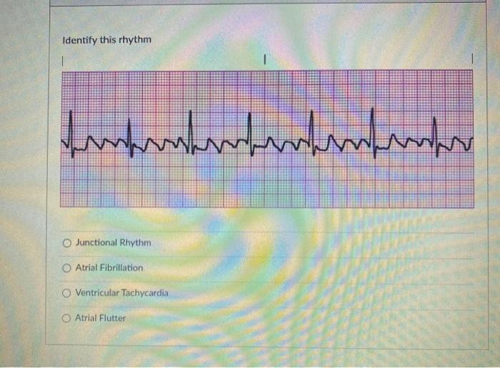 Solved Identify this rhythm. (Hint-no discernable P waves) | Chegg.com