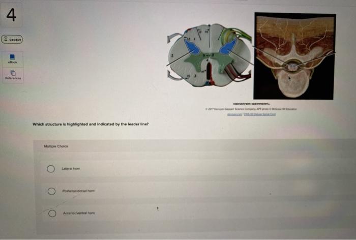 Solved: Which Structure Is Highlighted And Indicated By Th... | Chegg.com