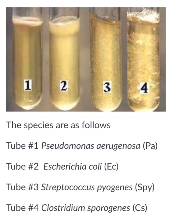 Solved PART I: Anaerobic Jar and candle Jar results 1. | Chegg.com