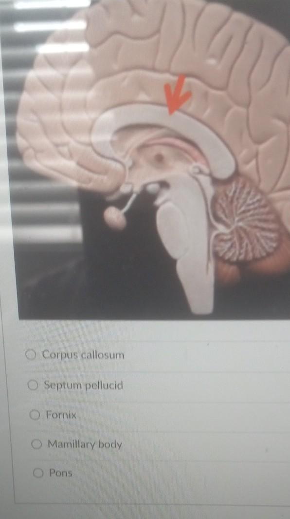 Solved Corpus Callosum Septum Pellucid Fornix O Mamillary 