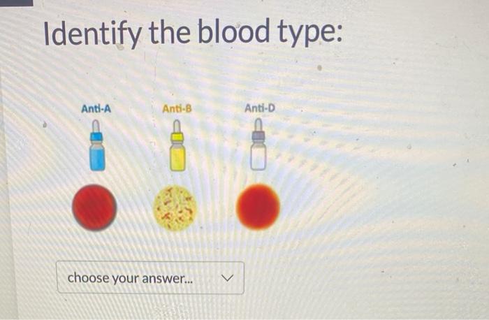 Identify the blood type: