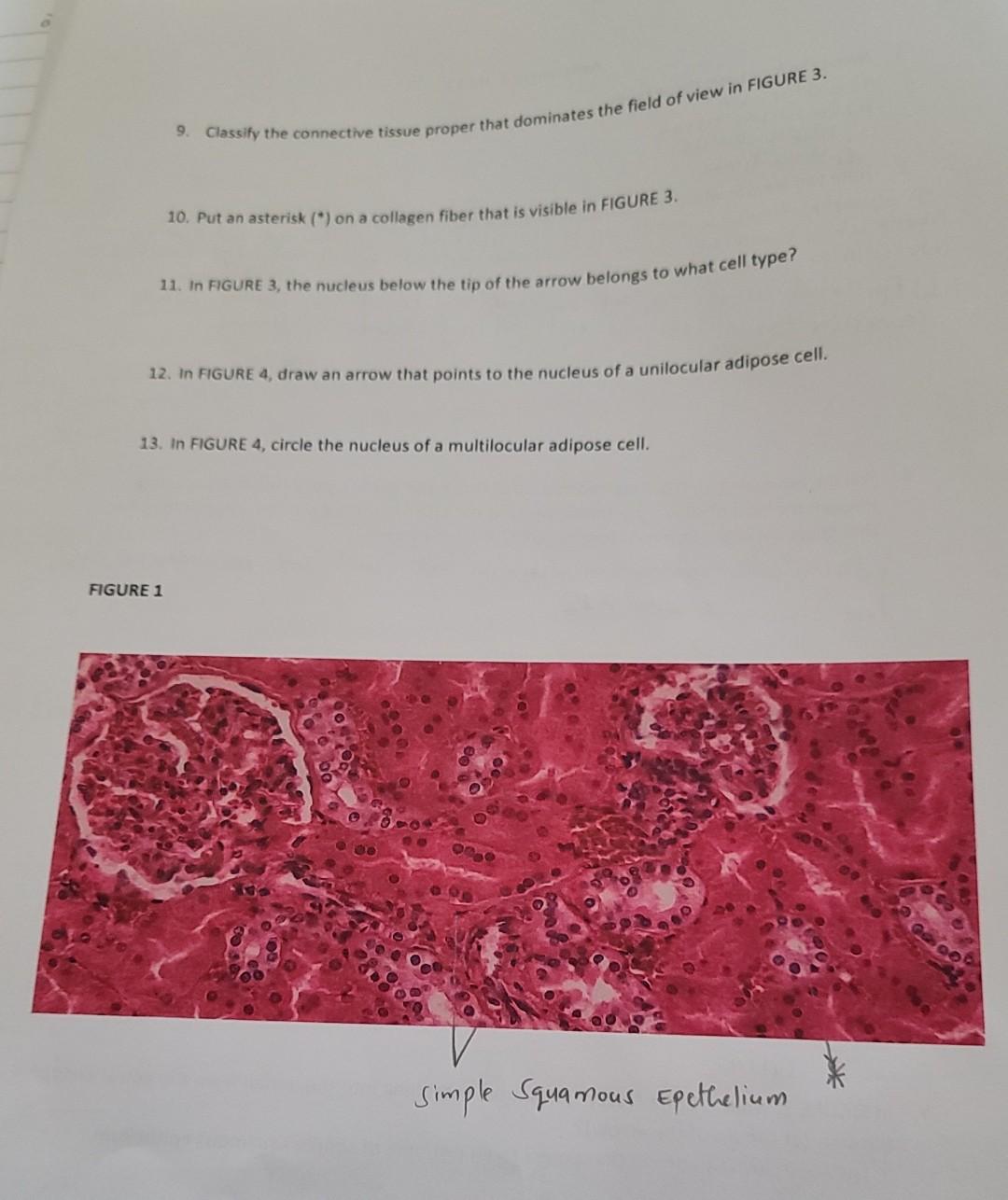 Solved Assignment 2, Unit 1 1. Name The Four Basic Tissue | Chegg.com