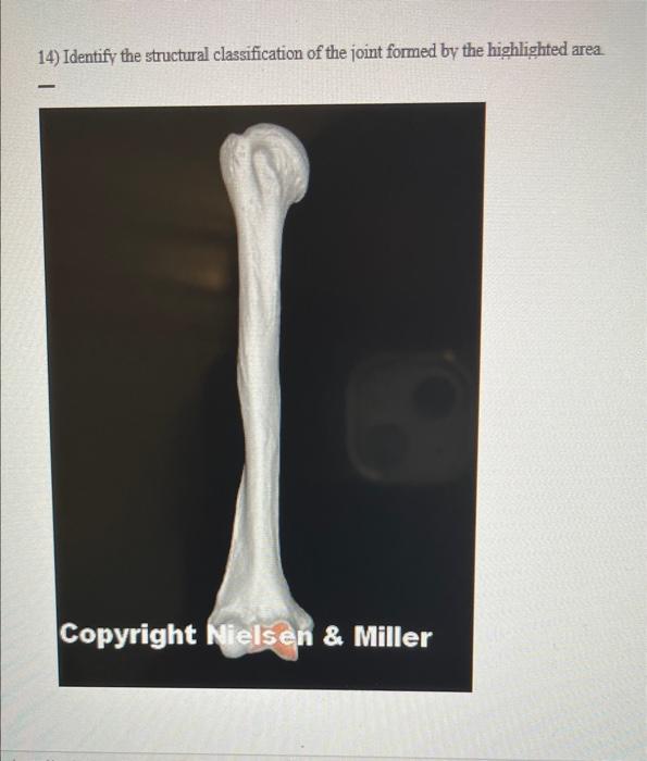 Solved 14) Identify the structural classification of the | Chegg.com