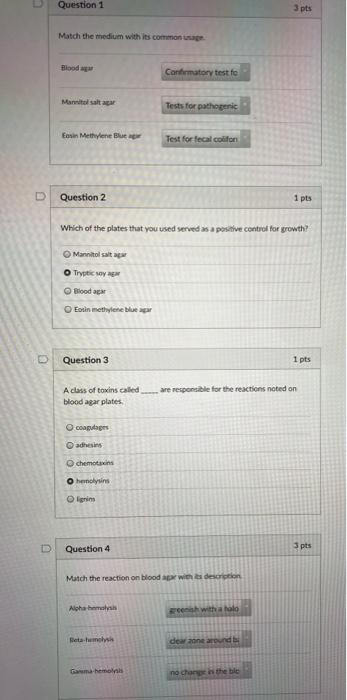 Solved Question 1 3 pts Match the medium with its common sa | Chegg.com