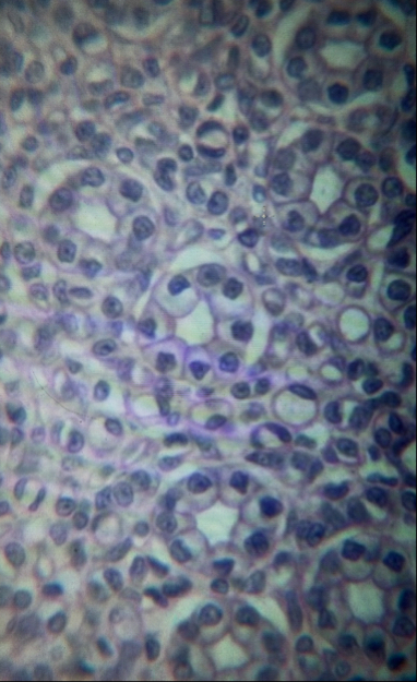 Solved Simple Cuboidal, Kidney cuboidal cells of a | Chegg.com