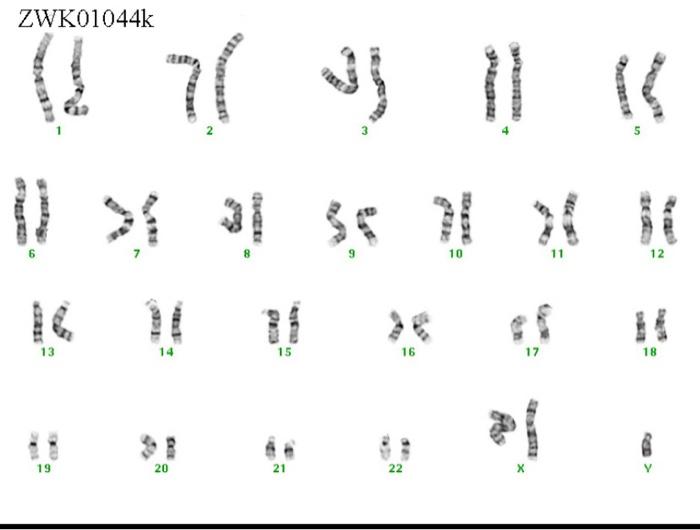 Solved #51) what is different about your karyotype2) what is | Chegg.com