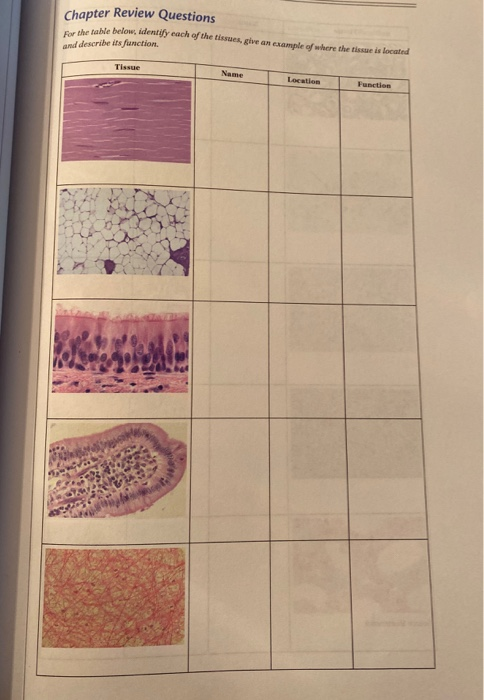 Solved identify each tissue, give an example of where it is | Chegg.com