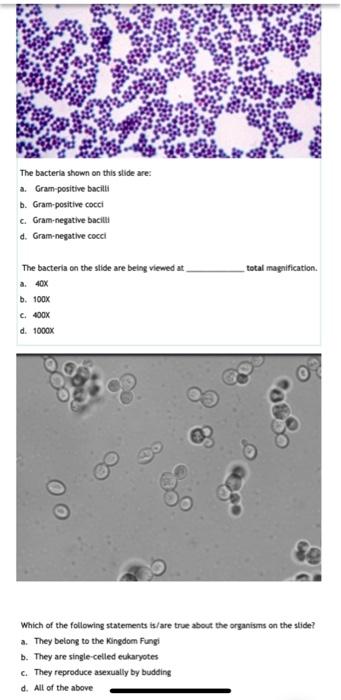 bacillus gram stain 100x