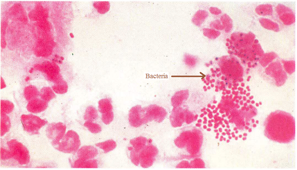 Neisseria Gonorrhoeae Morphology