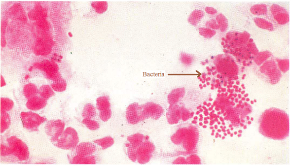 Neisseria Gonorrhoeae Gram Stain